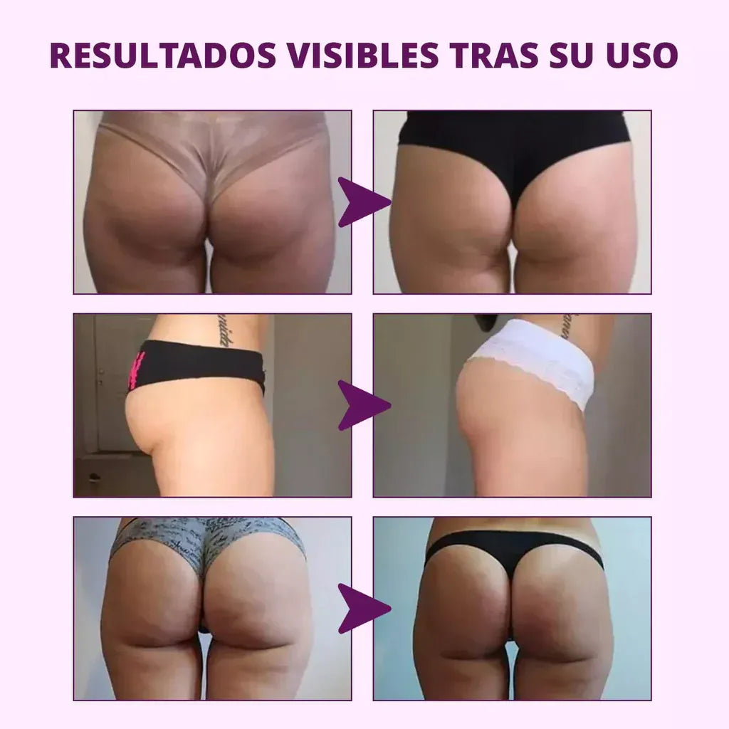 “Aceite Ultra Concentrado Para Glúteos. 30ml – Elevación Natural y Piel Más Firme”